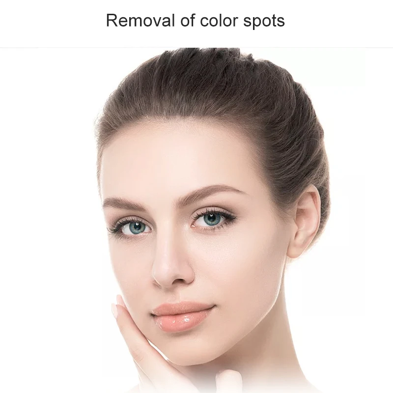 Крем для отбеливания и удаления веснушек быстрое удаление пятен отбеливание