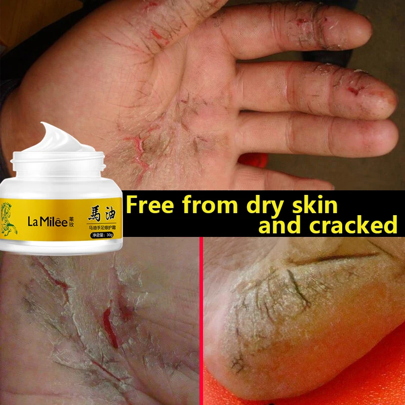 Конское масло крем для рук пятки пилинг ног восстанавливающий против сухой