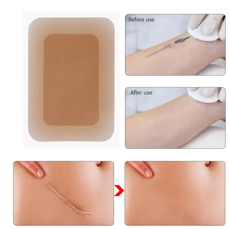 Татуировка дефект камуфляжная клейкая лента Водонепроницаемая Для постугревых