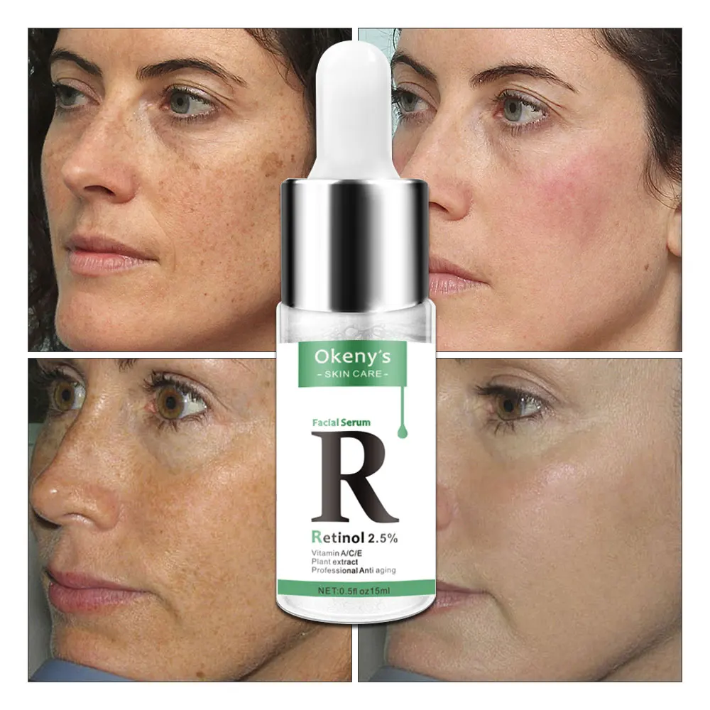Retinol 2.5% Vitamin C / A Facial Anti Wrinkle Serum Remove Dark Spots Collagen Whitening Face Aging Essence | Красота и здоровье