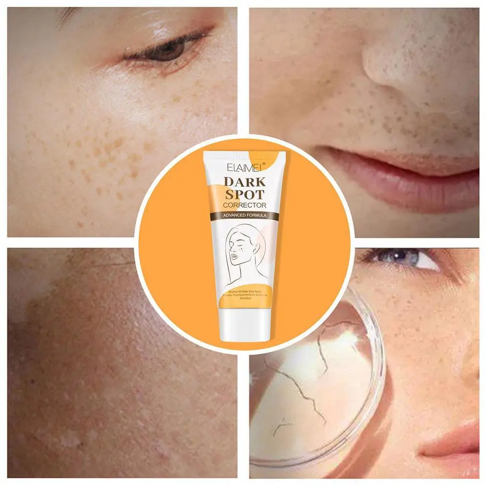 

Freckle Cream Dark Spot Corrector Skin Whitening Cream Removal Cells Lightening Marks Repair Scar Reduce Skin Serum Blemish O4J9