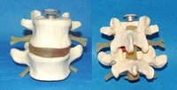adult 11 detachable 2 lumbar model lumbar disc bone skeleton model medical teaching explain human spine bone demonstration