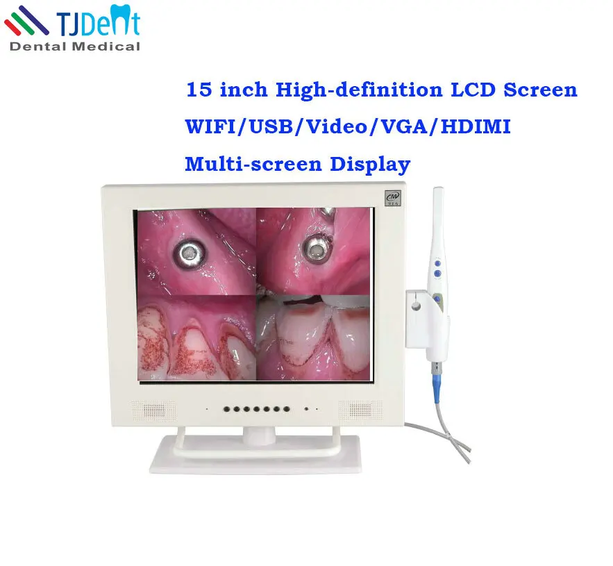 

15-дюймовый ЖК-экран CCD с высоким разрешением Wi-Fi Стоматологическая Интраоральная камера