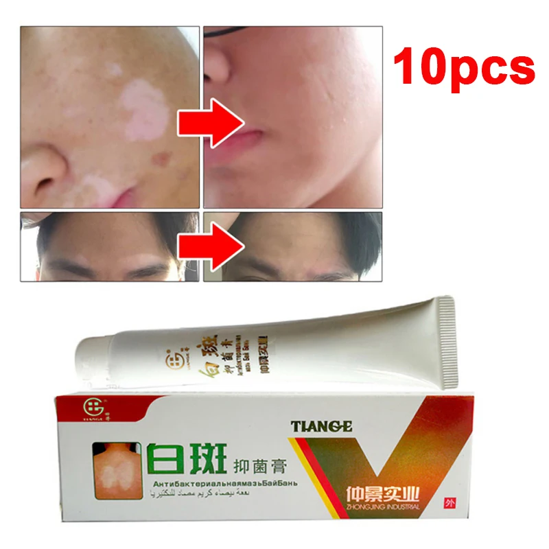 10 шт. китайский медицинский белое пятно болезни КРЕМ пигмент меланин поощрения