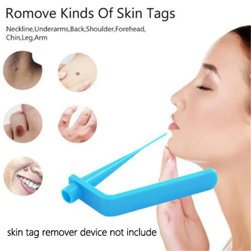 

Facial Skin Care Tool Tagband Skin Care Removal Meat Mole Removal Corn And Wart Skin Rubber Ring Skin Tag Skin Care Tool