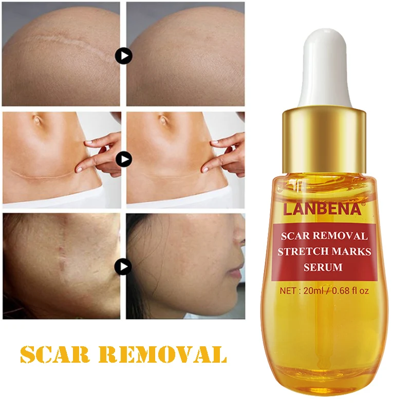 

Сыворотка для удаления шрамов от акне, угрей, пятен, пигментации