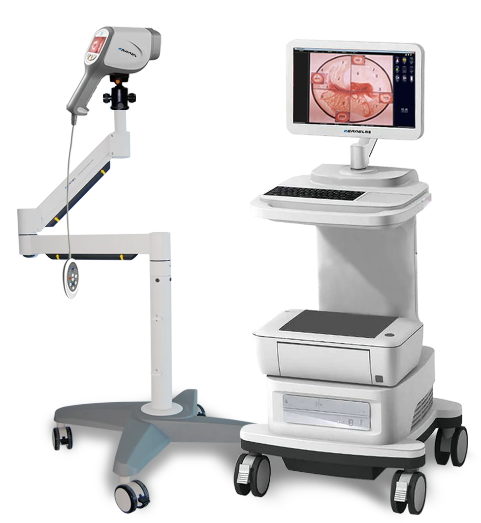 

Full HD SONY camera digital video colposcope for gynecology