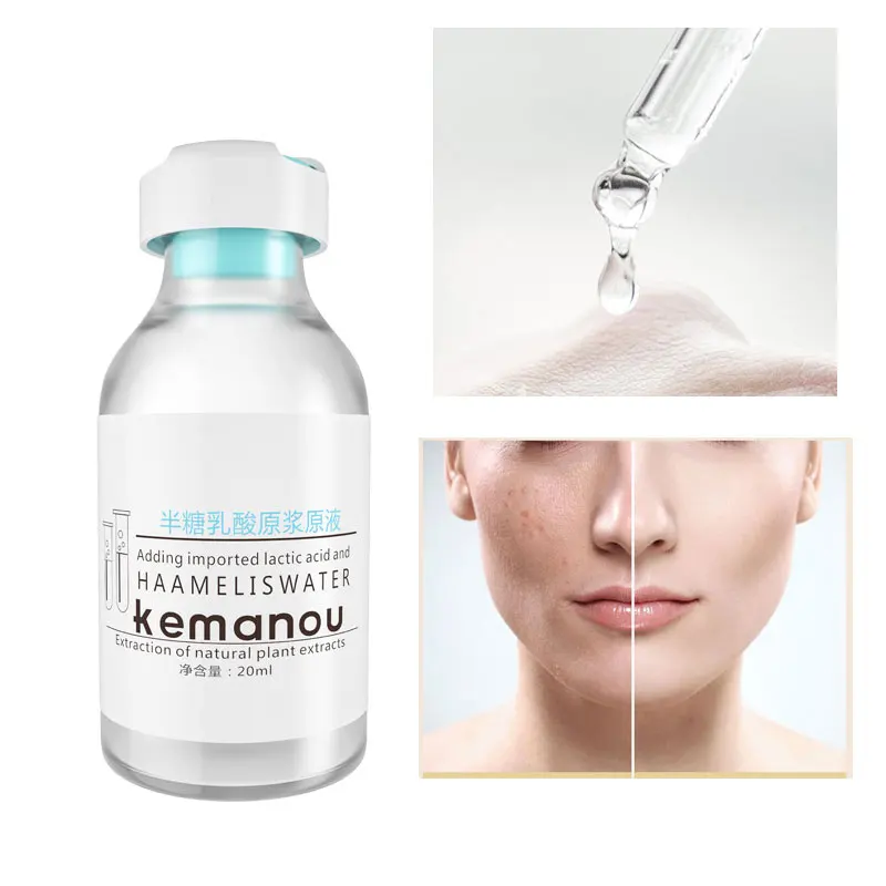 

Lactic Acid Face Serum Female Liquid Acne Treatment Peel Skin Skincare Peel Serum Oil Control Brightening Moisturizing