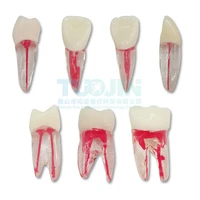 2pc dental root canal teeth model endodontics teaching modeling training tooth for student endo physical therapy practice tools