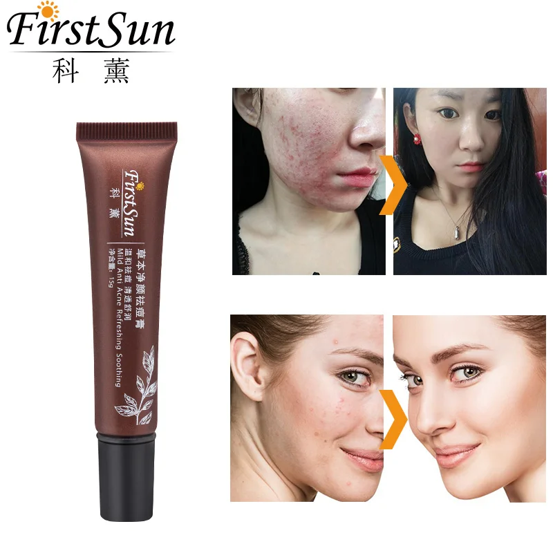 Firstsun травяной крем для лечения акне контроль жирности увлажняющий отбеливающий