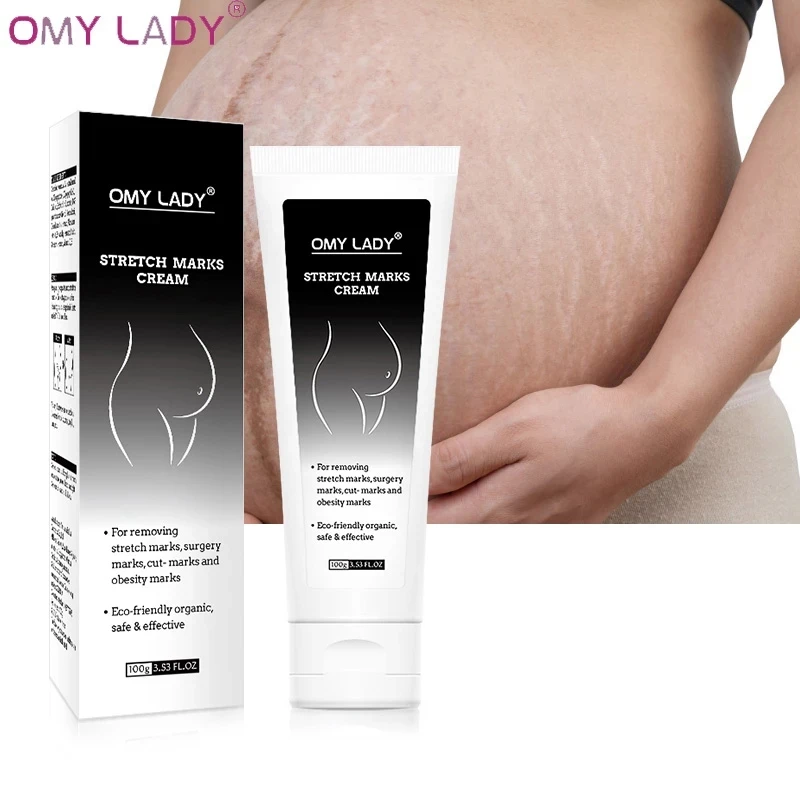 

OMY LADY 3 шт. эффективное удаление растяжек крем выцветание растяжек послеживание веса шрамы для хирургии удаление шрамов для беременных уход ...
