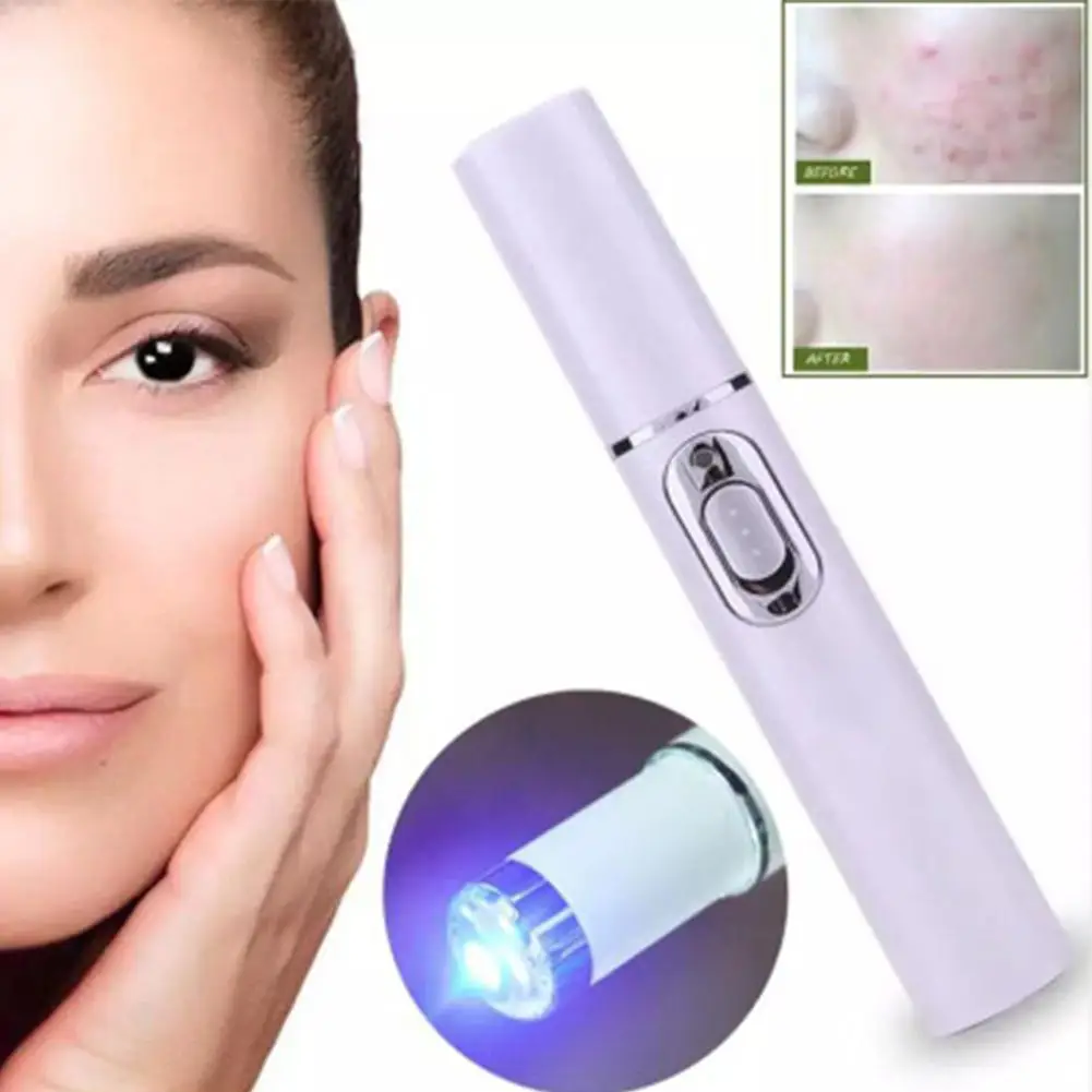 HobbyLane Blu-ray Acne Removing Blue Light Pen Scar Removal Anti Wrinkle Aging Therapy Beauty Device Face Beauty Machine Hot