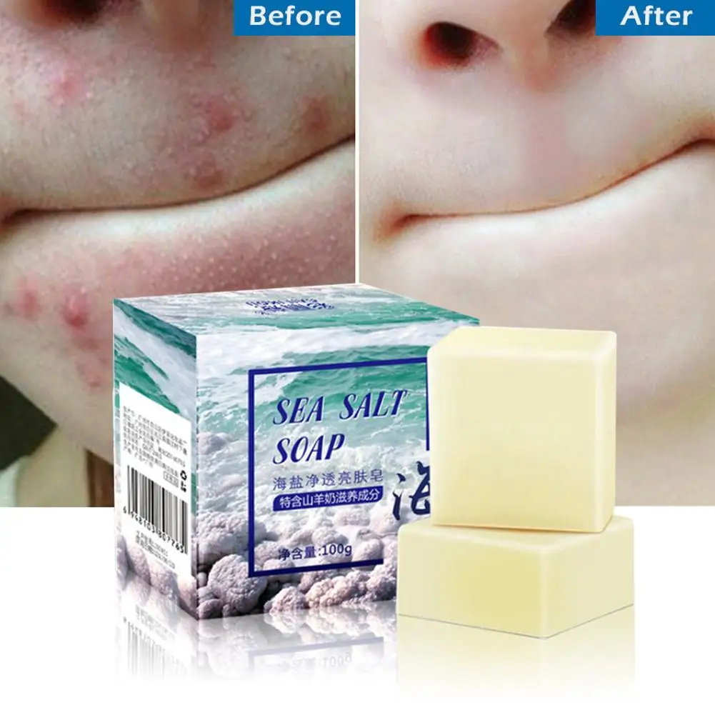 100g Whitening Soap Acne Treatment Removal Pimple Pore Salt Care Milk Sea Goat Face Basis Soap Wash Soap Soap Handmade P3Q4