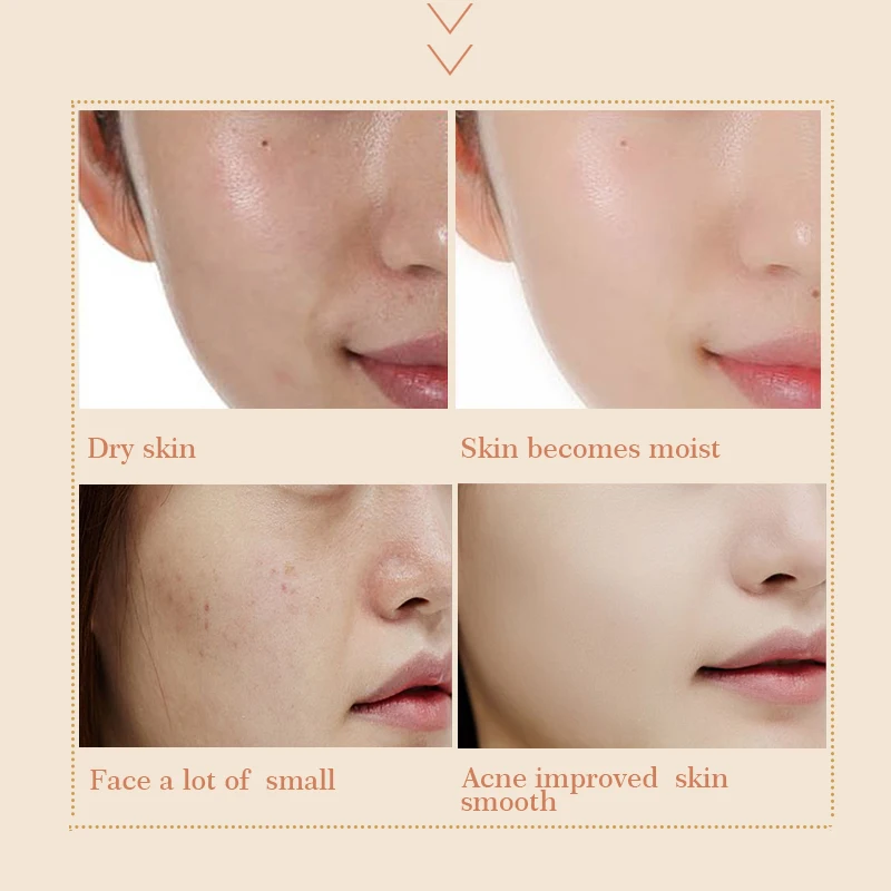 

Snail Cream Collagen Anti-Wrinkle Whitening Face Cream Hyaluronic Acid Moisturizing Anti-aging Nourishing Serum Remove Freckles