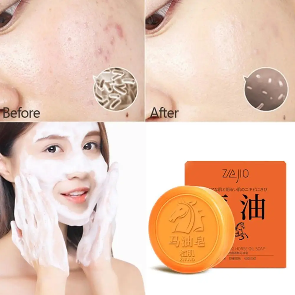 80 г конского масла мыло ручной работы для угрей уход чистый натуральный Тип