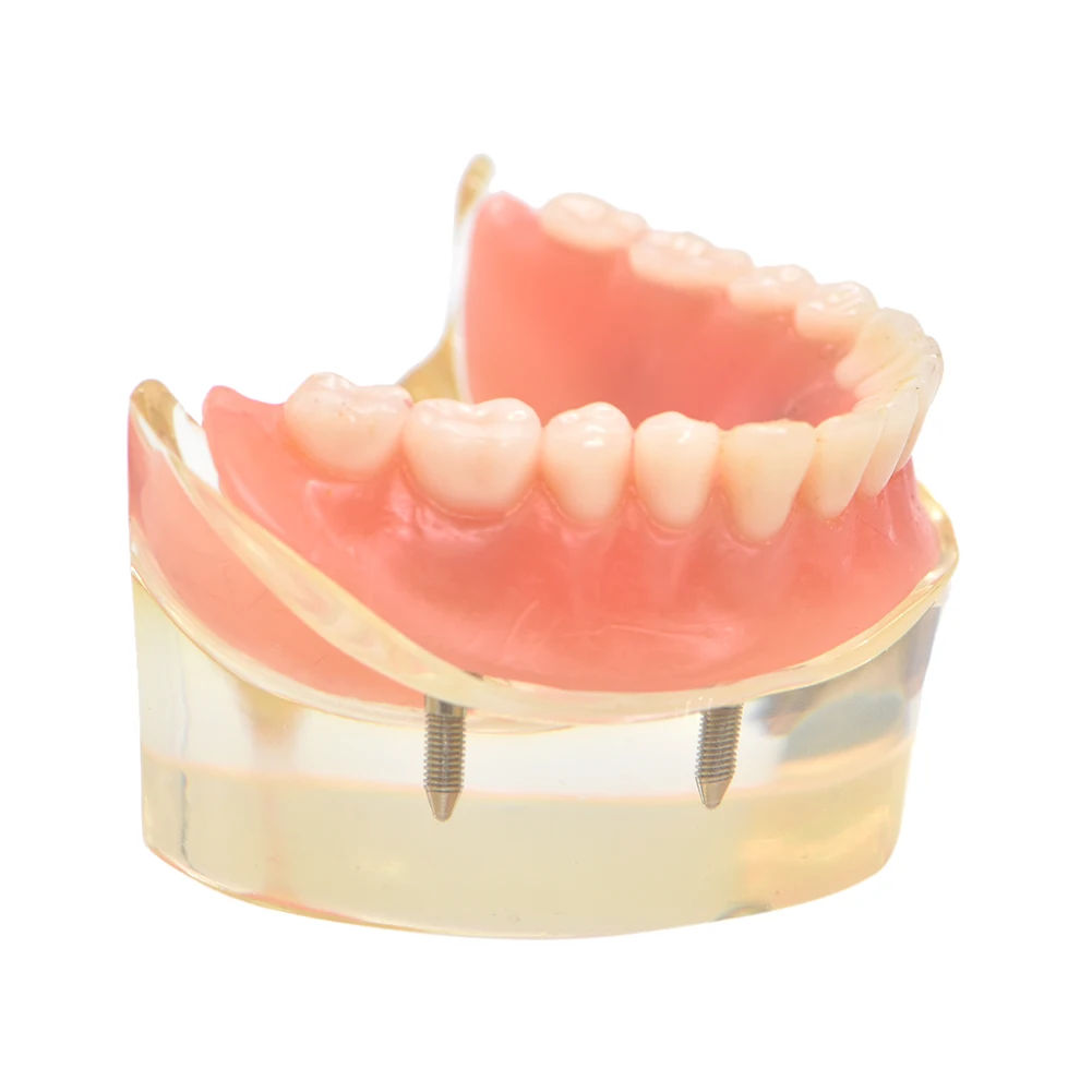 Модель зубного протеза съемная внутренняя модель нижних зубов Mandibular с