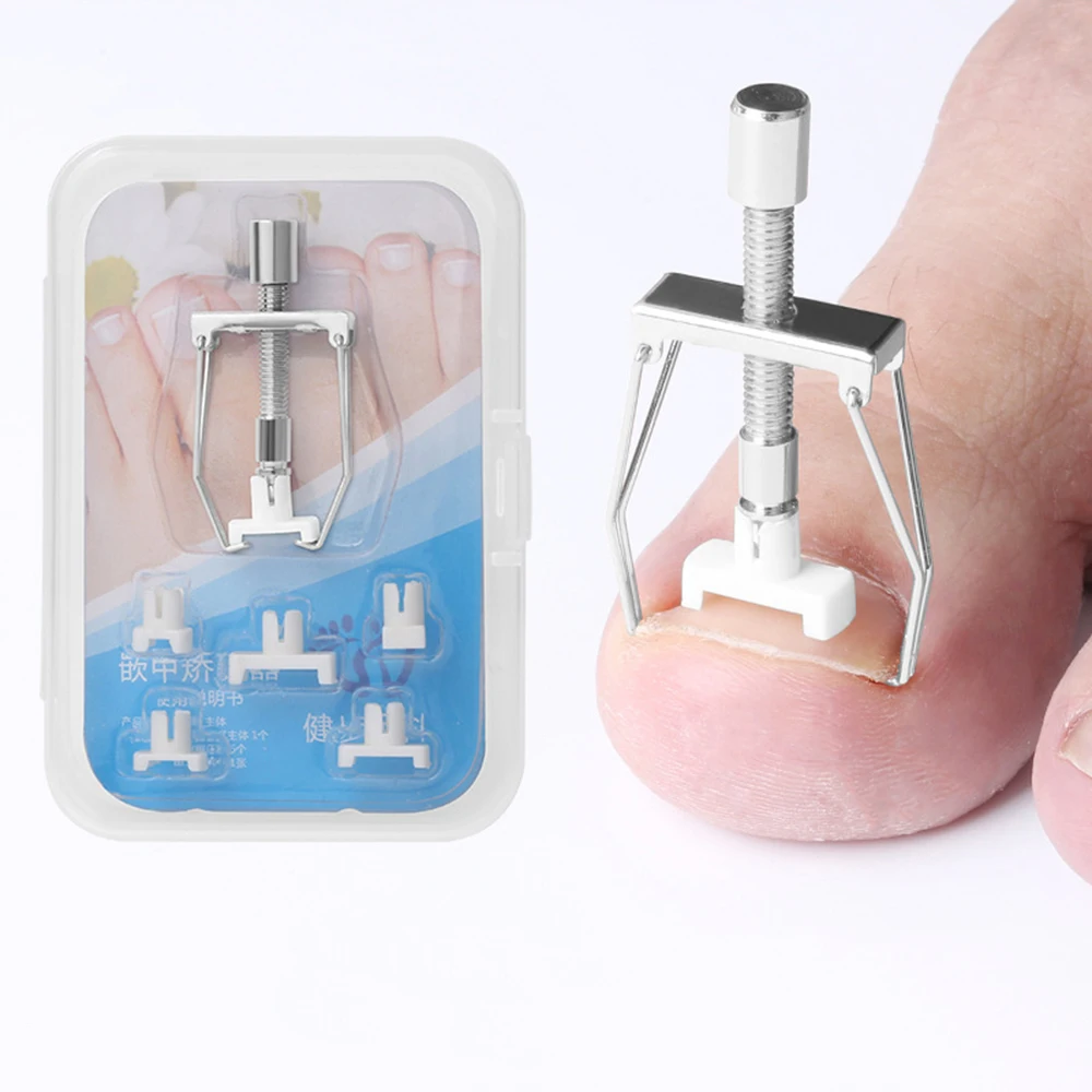 

Ingrown Nail Recover Correction Pedicure Toenail Fixer Ingrown Foot Nails Care Tool Orthotic Toe Nail Corrector Pedicure Tool