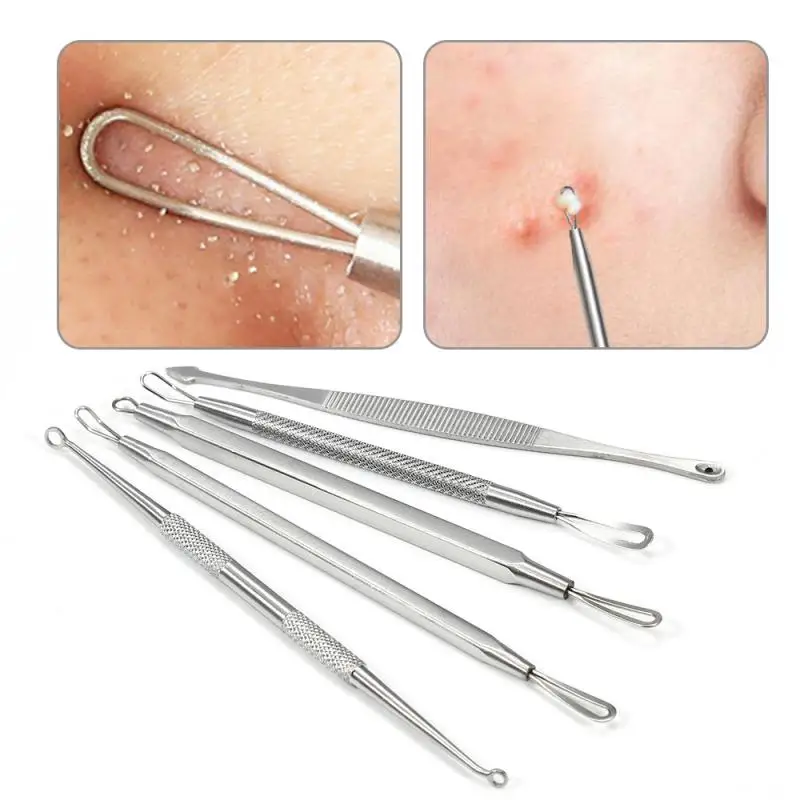 5 шт. набор инструментов для удаления черных головок из нержавеющей стали пинцет
