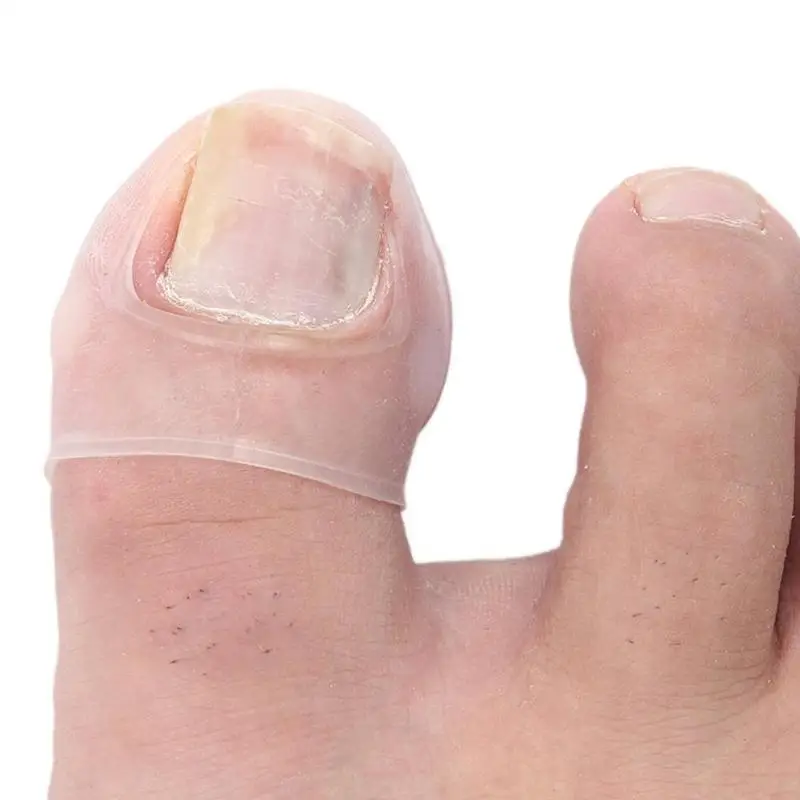 2 шт. эластичная заплатка Стикеры выпрямление волос Клип Держатель Скоба вросшие