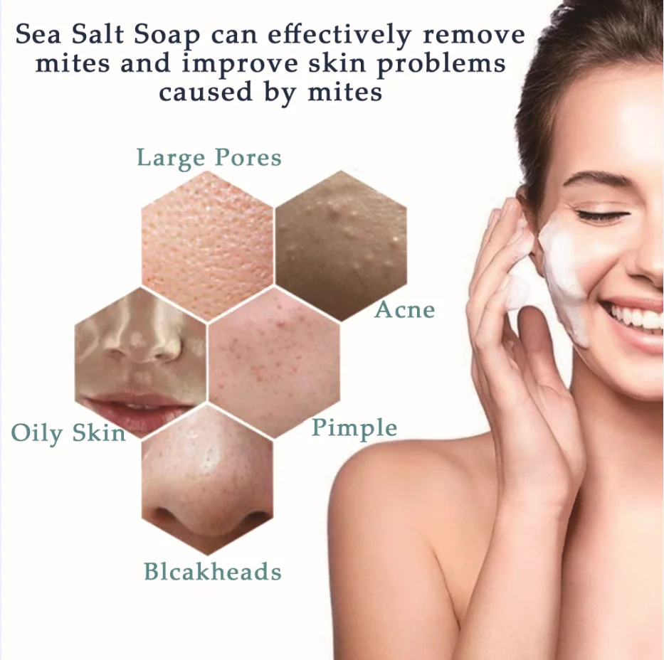 Морская соль мыло для удаления прыщей поры акне терапии морская очиститель