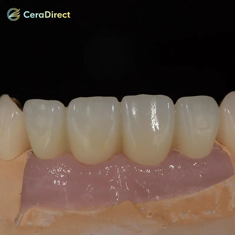 Ceradirect 3D Pro многослойная циркониевая открытая система (98 мм) для стоматологической