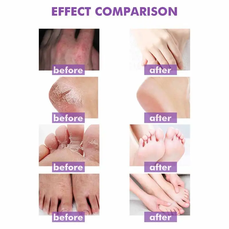 Восстанавливающее Средство для сухих зуд и чувствительную кожу регенерирующий