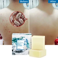 10pcs removal pimple pore acne treatment sea salt soap cleaner moisturizing goat milk soap face care wash basis soap