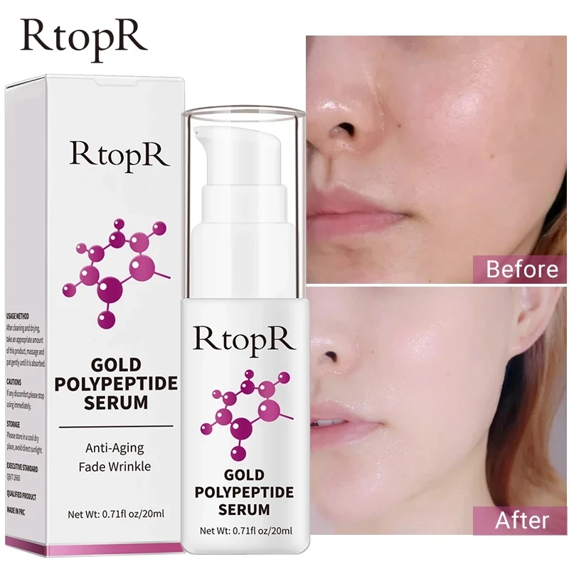 Антивозрастная отбеливающая сыворотка с гиалуроновой кислотой 20 мл | Красота и