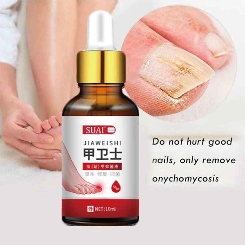 

Nail Fungal Treatment Feet Care Essence Nail Foot Whitening Toe Nail Fungus Removal Gel Anti Infection Paronychia Onychomycosis
