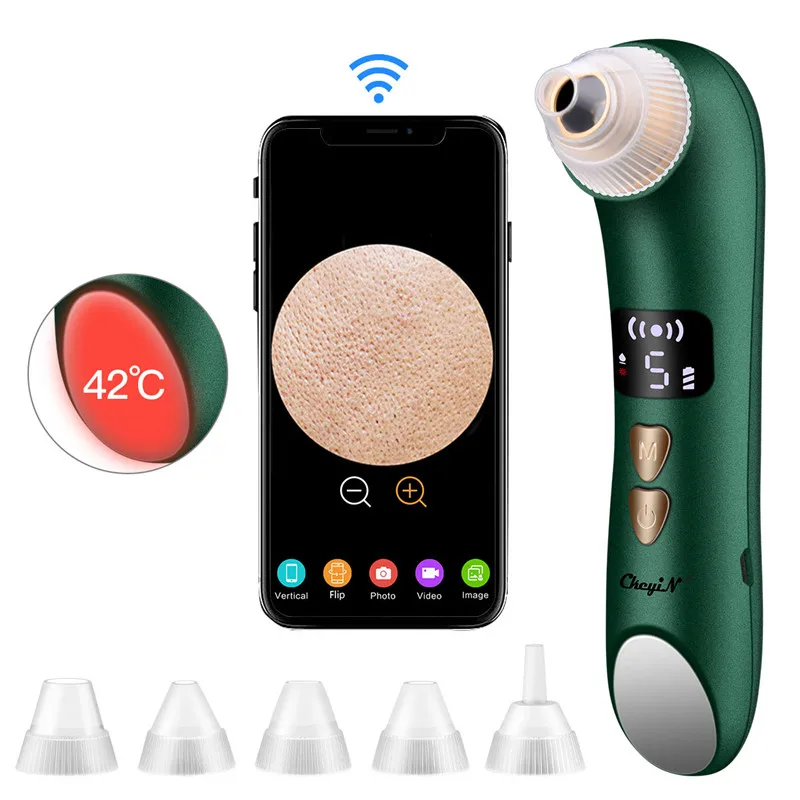 Kopen Ckeyin Ultrasone Facial Scrubber Vacuüm Comedondrukker Hot Comprimeren Led Photon Gezicht Lifting Aanscherping Anti Aging Huidverzorging