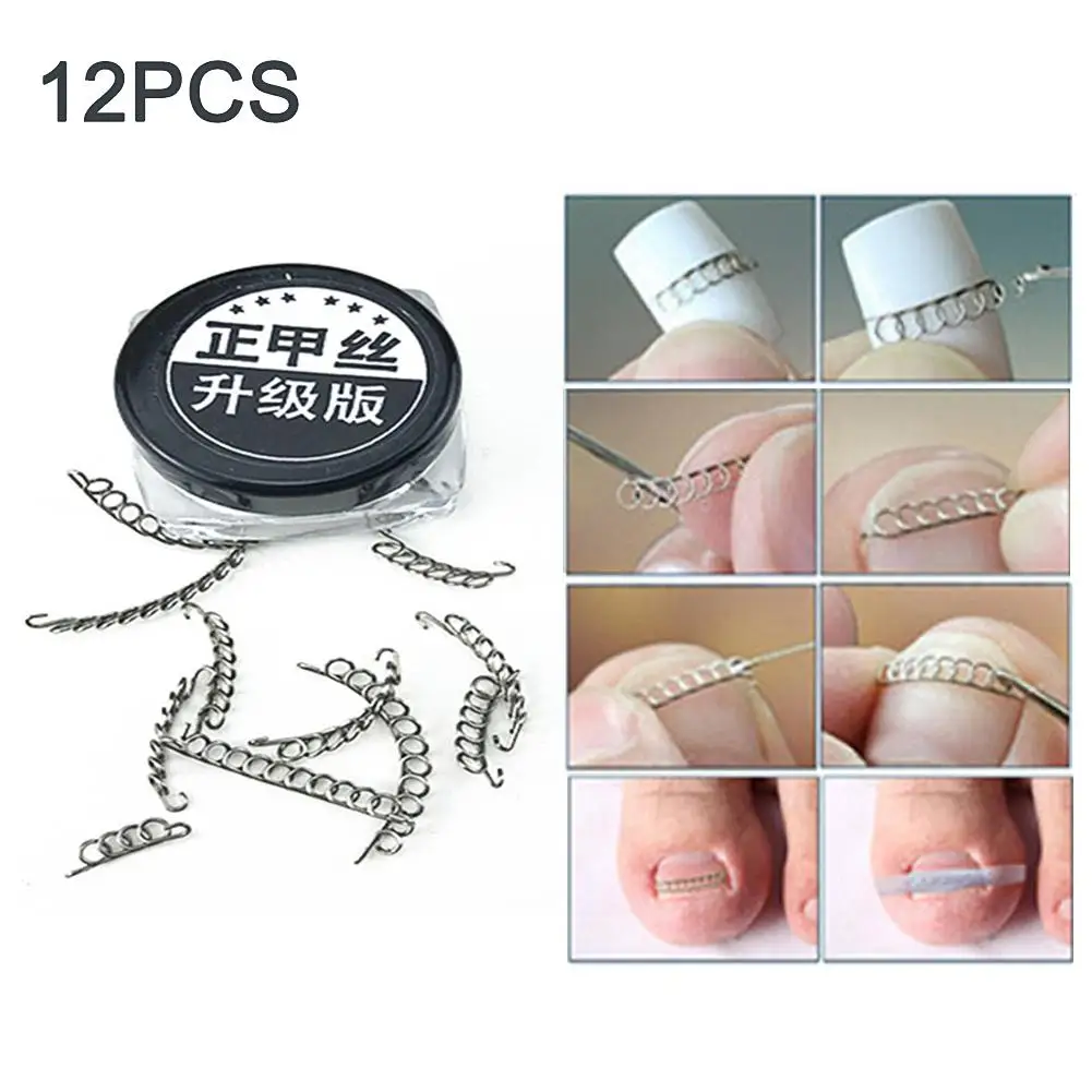 Nail Art Ingrown Toe Correction 12Pcs Wire Pedicure Toenail File Patch Corrector Foot Tool | Красота и здоровье