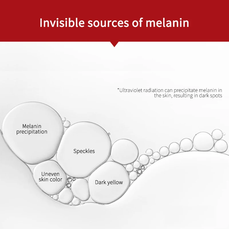 Крем для отбеливания веснушек удаление мелазмы темных пятен меланин осветления