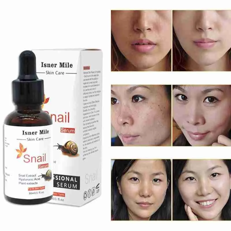 

30ml Whitening Snail Serum Essence Anti-acne Rejuvenated Liquid Care Hyaluronic Skin For Women Acid Moisturizing Beauty Sna I4U8