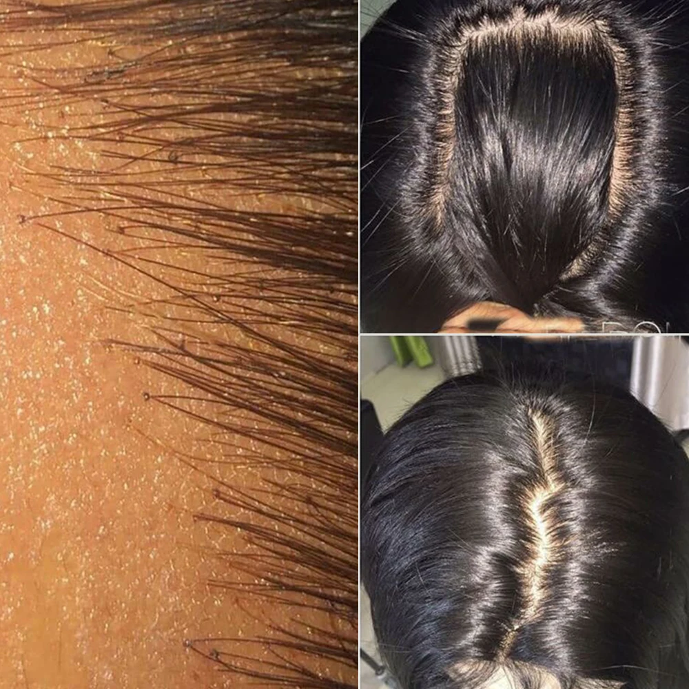 BLACROSS Striaght Closure or HD Frontal Lace 4x4 Human Hair 5X5 6X6 Per Plucked Hairline Brazilian Be Dyed Virgin | Шиньоны и парики