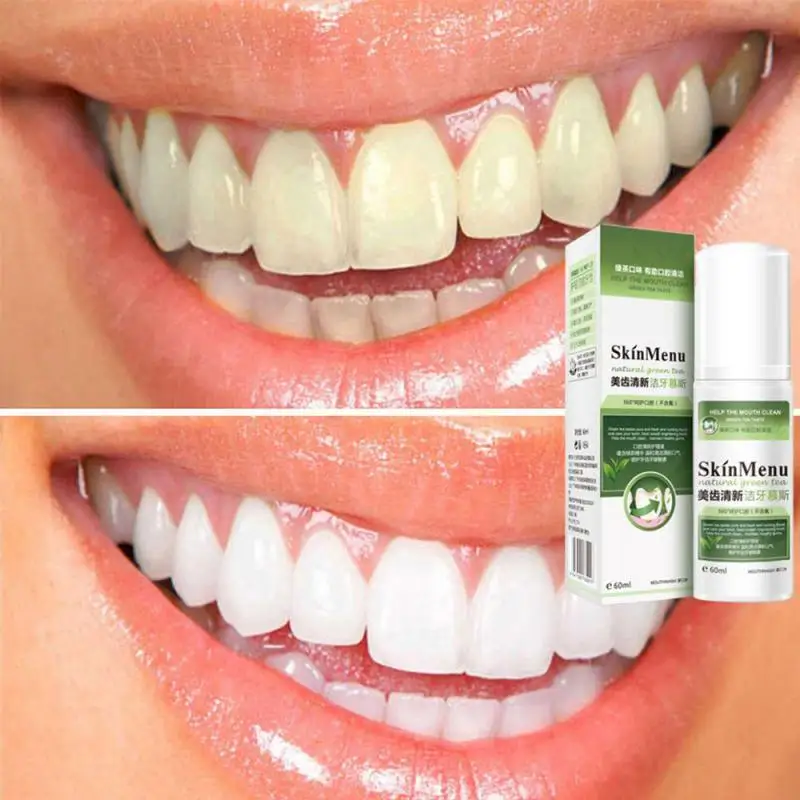 60 мл отбеливающий крем зубная паста свежее удаление от зубных пятен чистка зубов