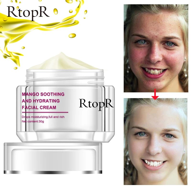 

RtopR Face Cream Anti-Wrinkle Anti Aging Whitening Mango Bright Moisturizing Liquid Tights Nourishing Shrink Pores High Quality
