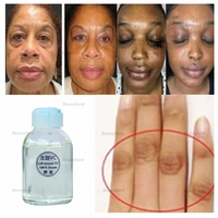 corrective skin lightening cream for hyperpigmentation of hands and feet