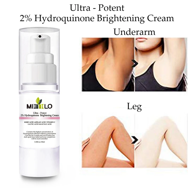 Отбеливающая Сыворотка для лица осветляет цвет кожи удаляет веснушки крем ухода