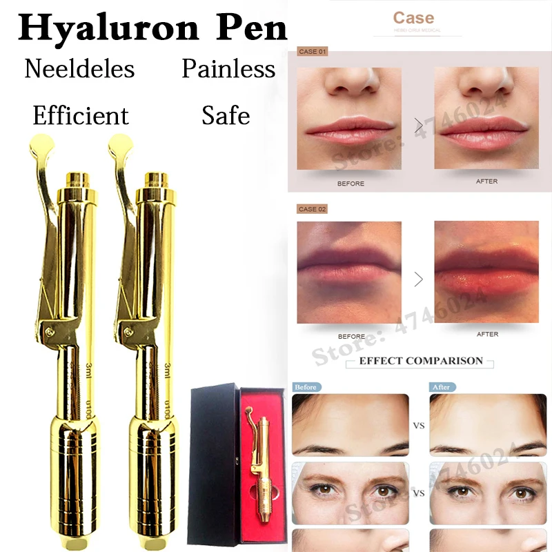 

0.3ml Gorgeous Lip Injection Gold Pen Anti Aging Hyaluron Pen Dermal Filler Atomizer Hyaluronique Acid Injector Wrinkles Removal