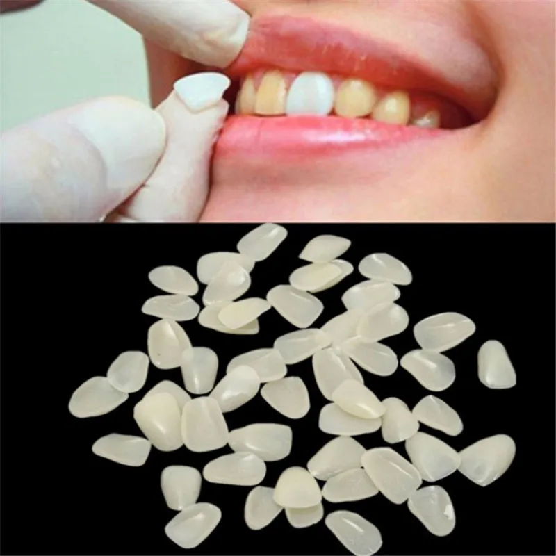 

Dental Temporary Crown Ultra Thin Resin Whitening Teeth Anterior Shade Tooth Veneers Fashion Teeth Care Tools 70pcs/pack