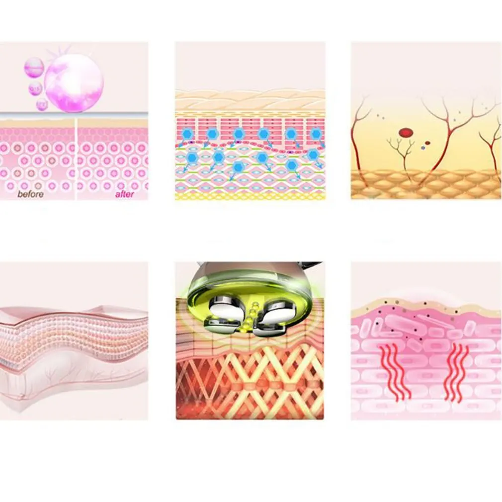 

RF radiofrequency machine ultrasonic facial cosmetology equipment EMS skin tightening device Massager face light therapy tools