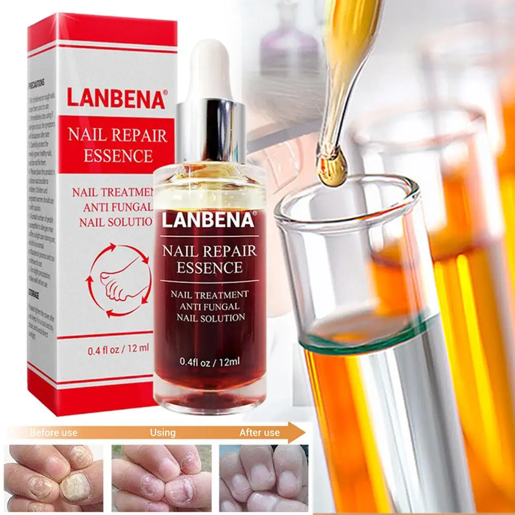 Лечение ногтей от грибка Уход за ногами и ногтями ремонт эссенция