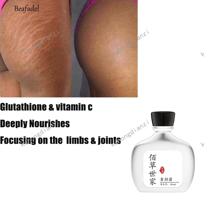 

Stretch Marks Remover Stretch Marks Reversal Cream Stretch Marks Remover Shipping Cream Pregnant Woman Drop Skin Care 180ml