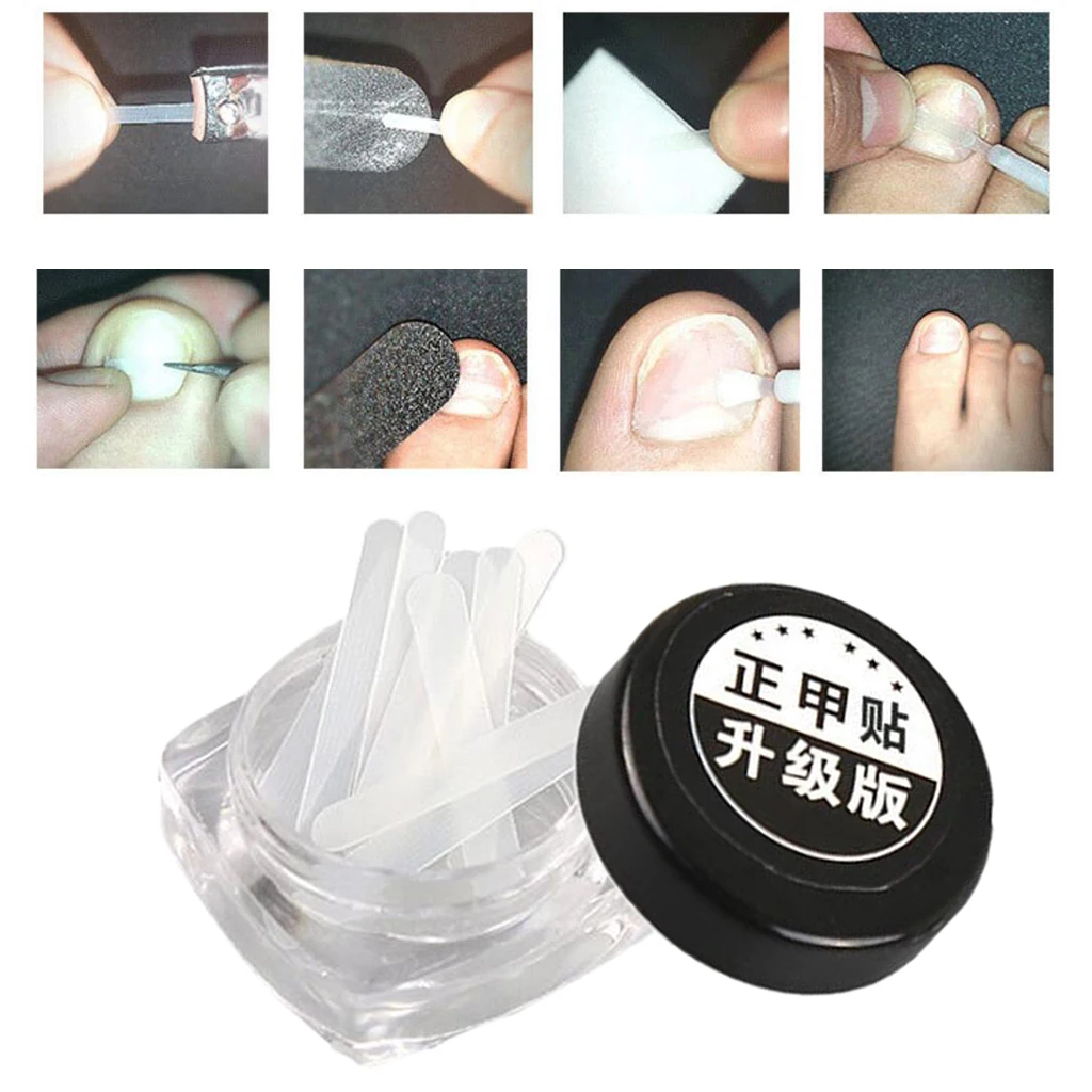 

10Pcs Ingrown Toenail Correction Sticker Foot Pedicure Tool Toenail Corrector