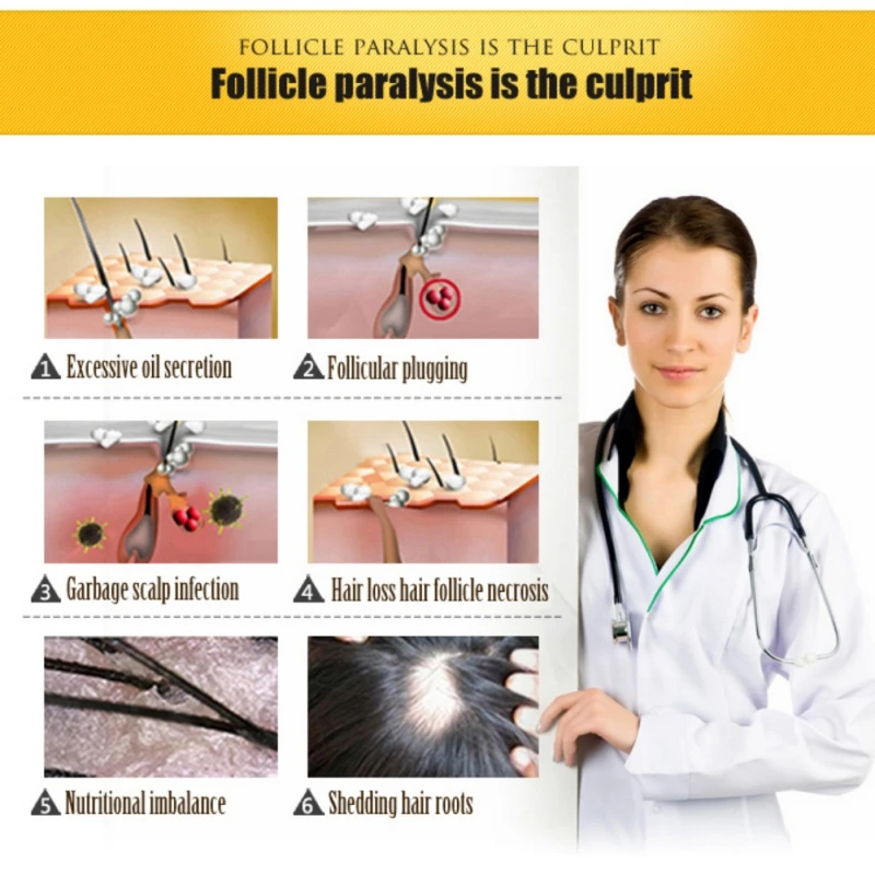 2018 эссенция для роста волос Традиционная китайская медицина натуральный имбирь