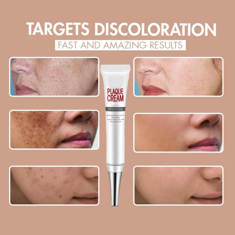 

Effective Whitening Freckle Cream Remove Melasma Acne Spot Pigment Melanin Dark Spots Pigmentation Moisturizing Skin Care TSLM1