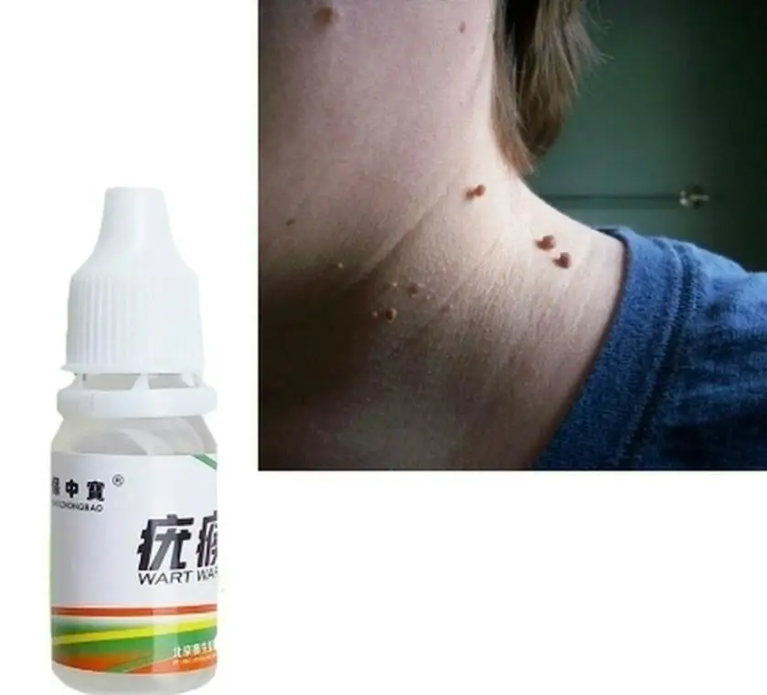 10 мл средство для удаления кожных тегов 12 часов Tu kill Medical Remover Skin Tag Mole & Genital