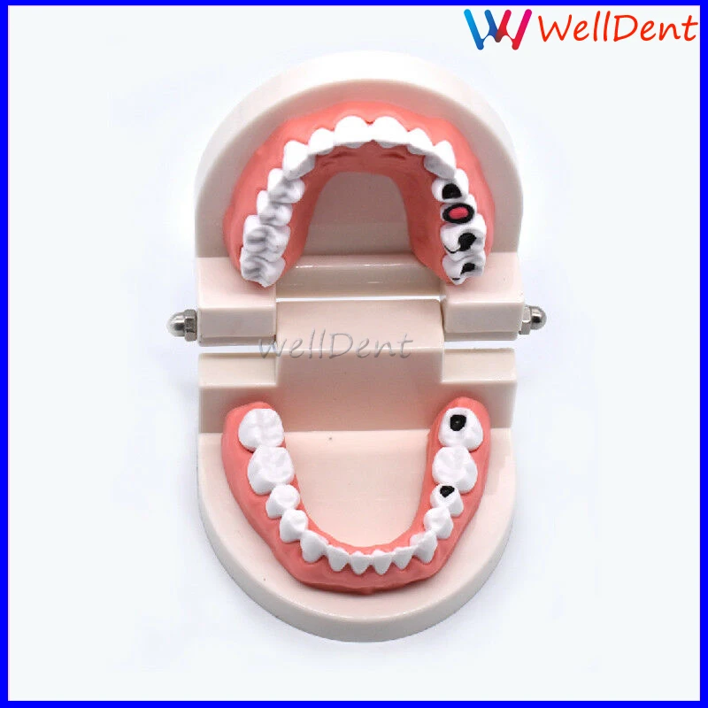 Стоматологическая модель зубов кариесы уход за зубами обучение
