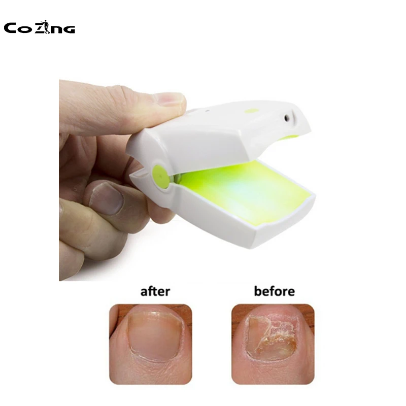

Nail Treatment Device Onychomycosis Therapy Apparatus Laser Light Therapy Device