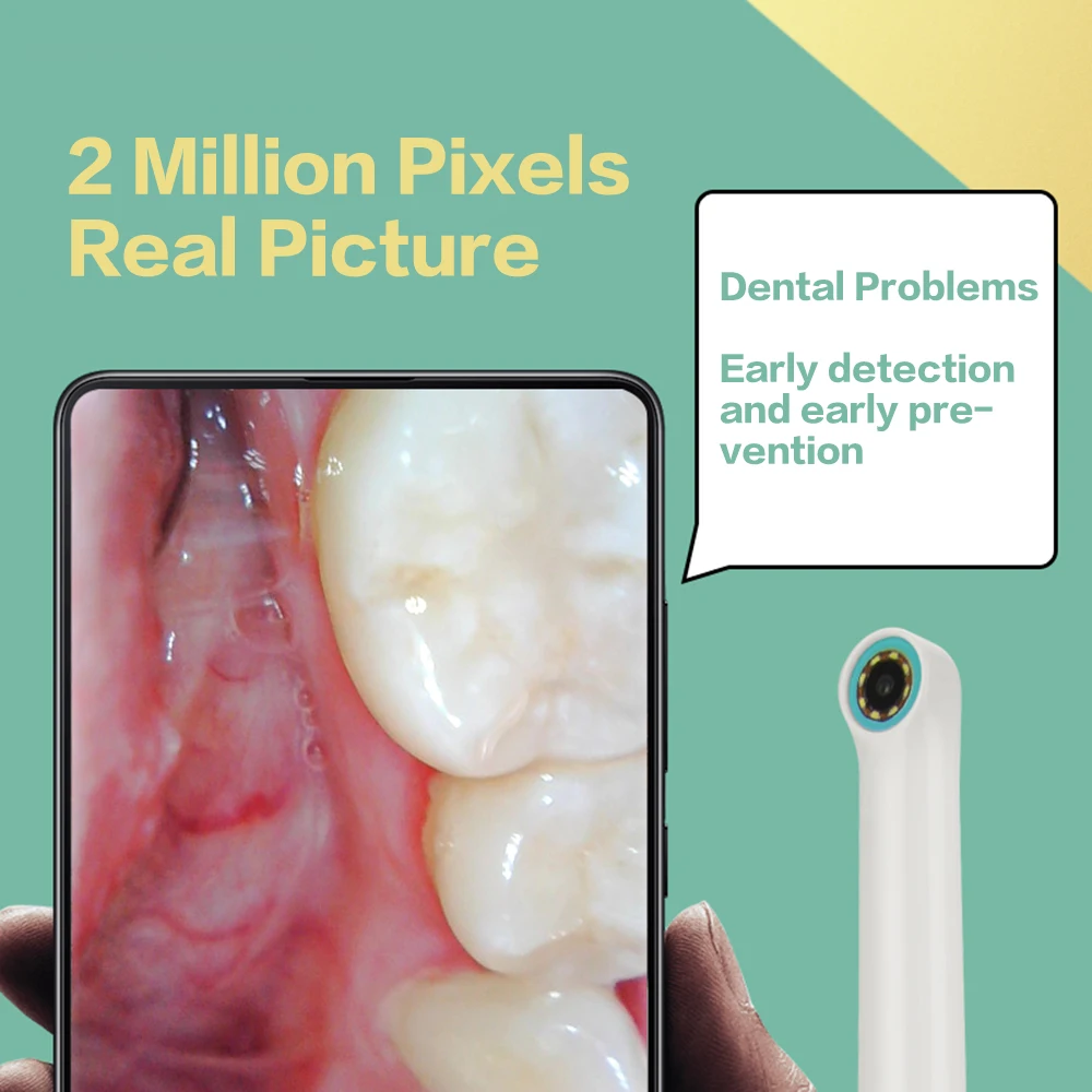 Цена Wi-Fi стоматологический эндоскоп интраоральная камера 1080P HD Беспроводная внутриполостная одонтология стоматология зубы проверка для IPhone IPad ...